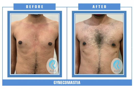 Slider image (3) ALCS - Hair Transplant &  Cosmetic Clinic